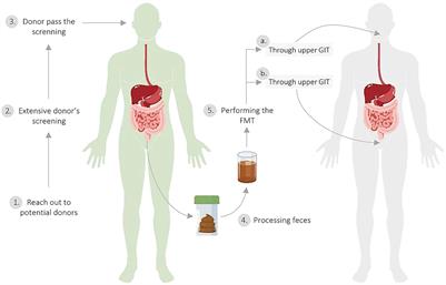 Fecal microbiota transplantation—could stool donors’ and receptors’ diet be the key to future success?